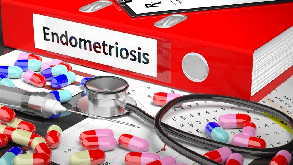 Какво е ендометриоза?